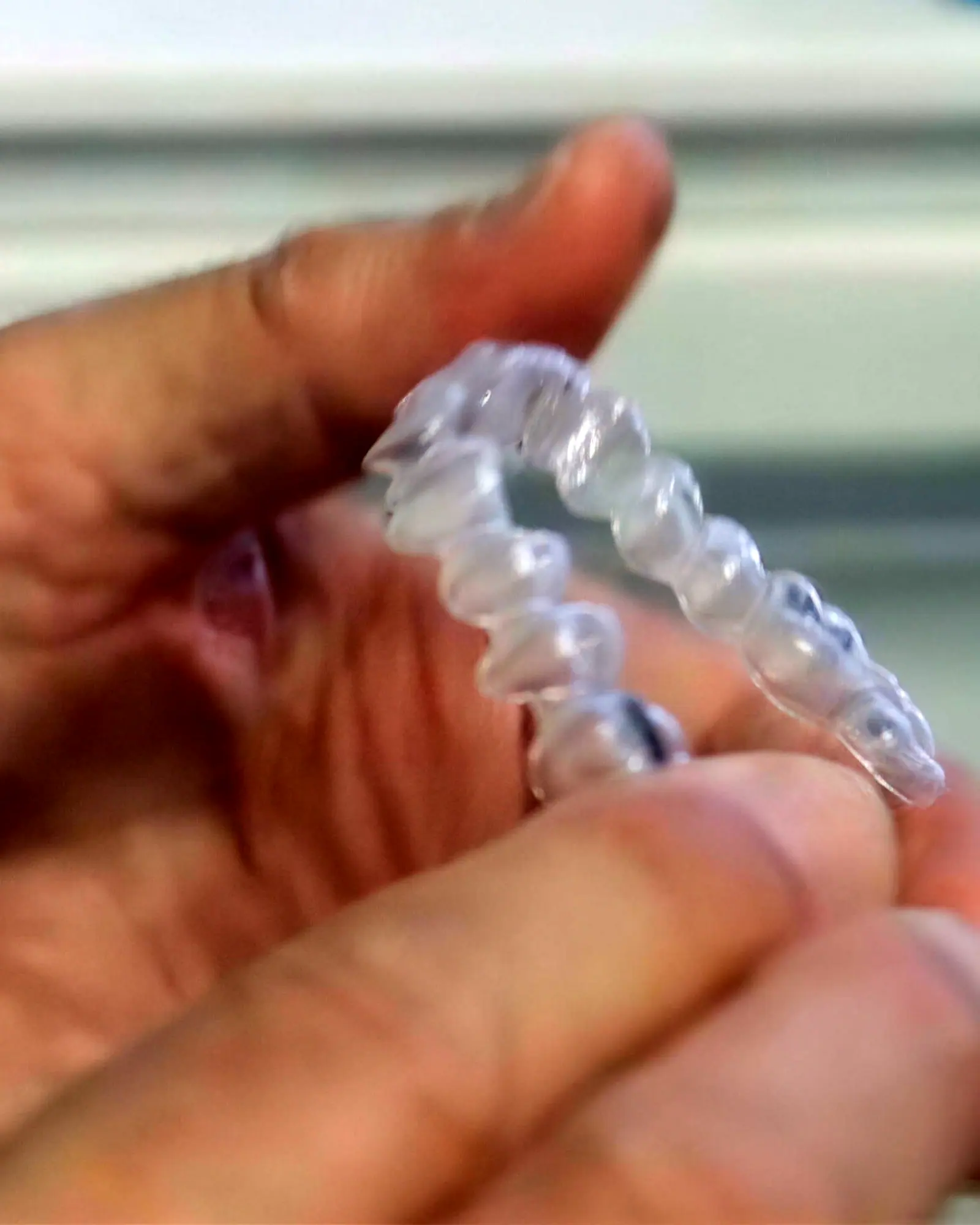 Un allineatore trasparente fra le dita di un dentista dello studio
